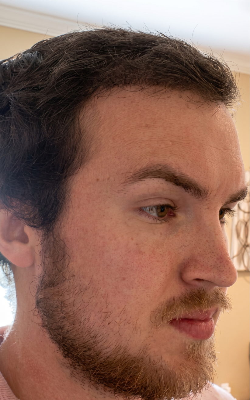 Avery — after, side profile