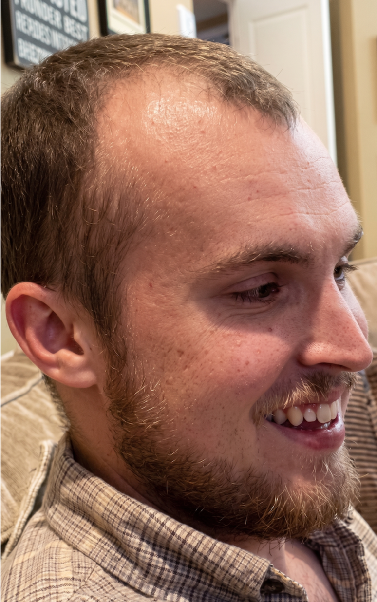 Avery — before, side profile