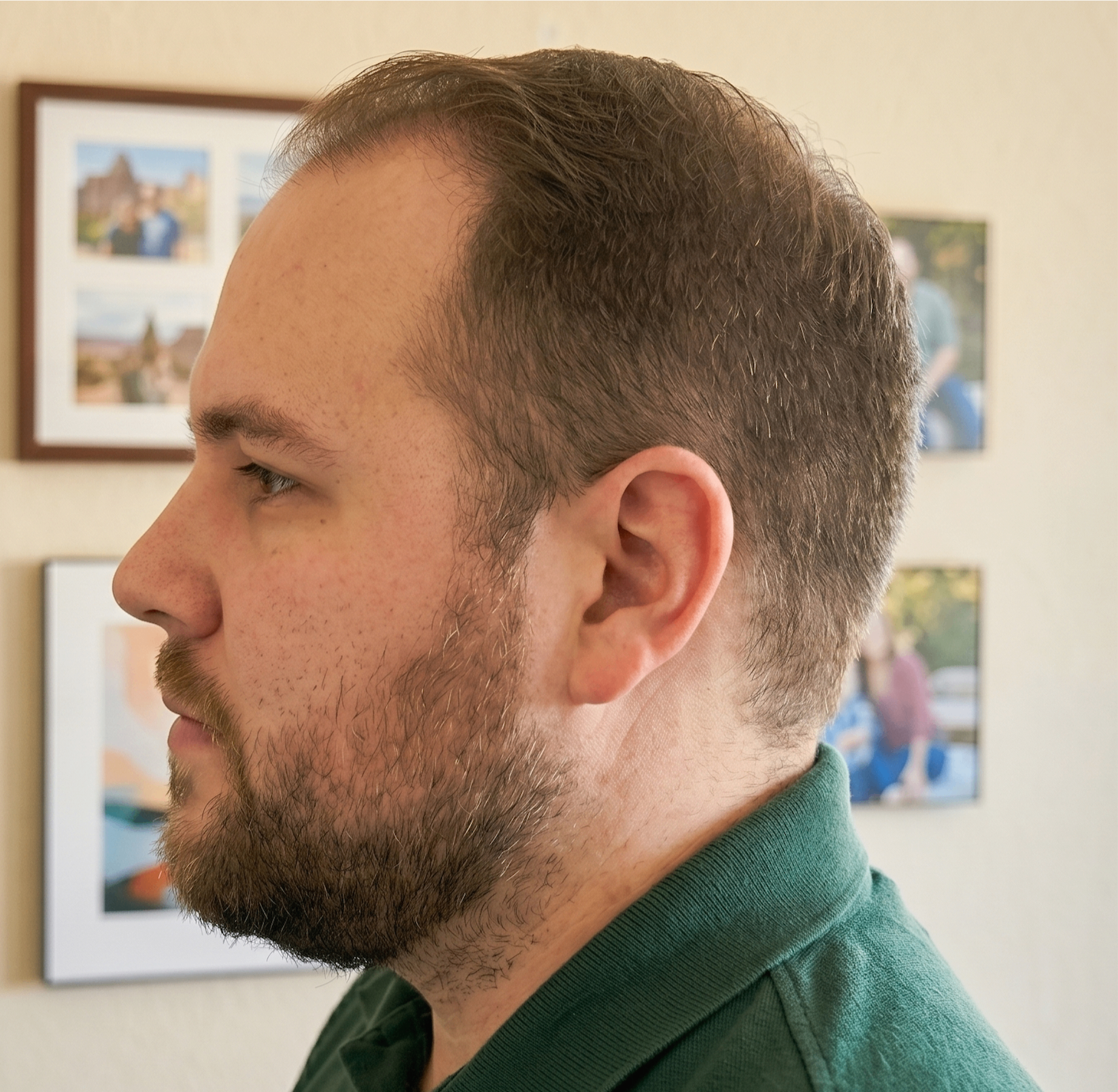 Chuck — before, side profile