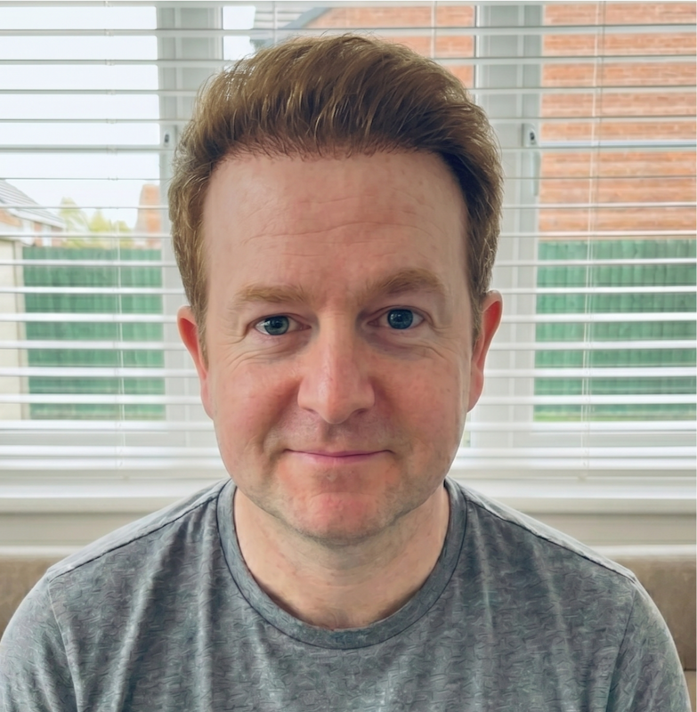 Craig — after, front