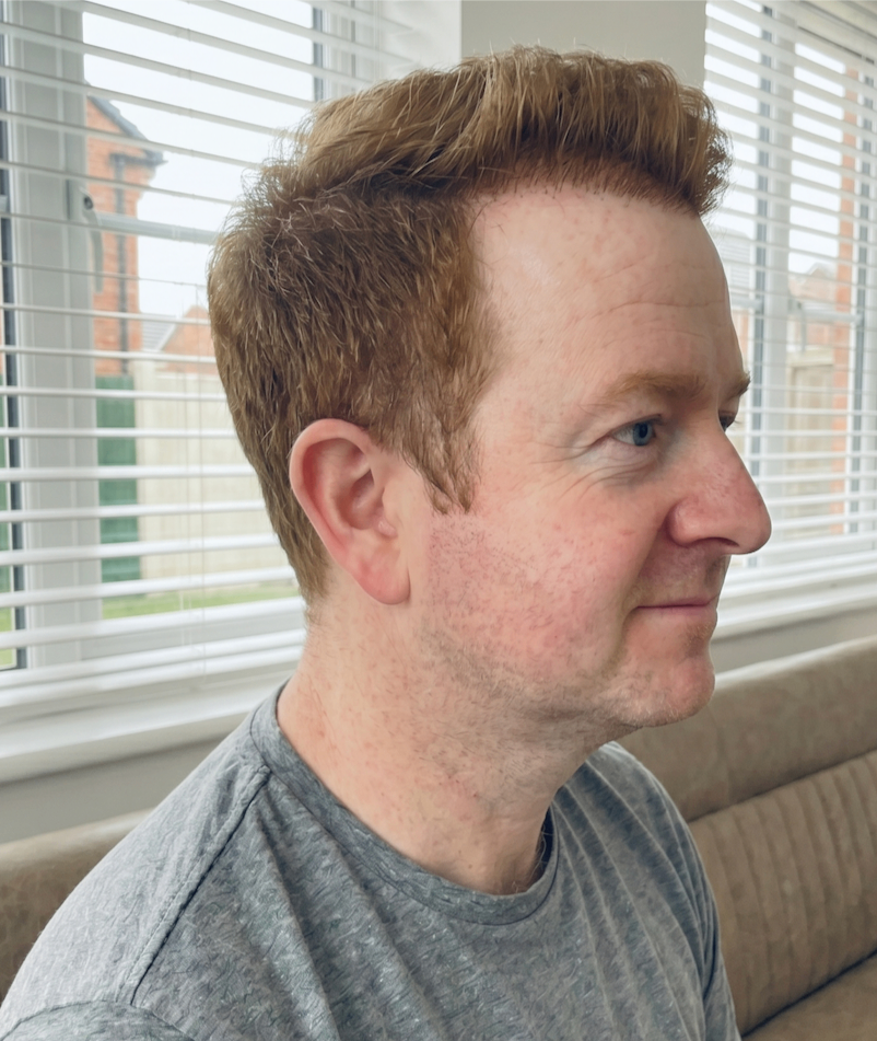 Craig — after, side profile