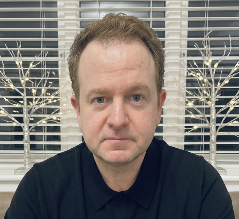 Craig — before, front